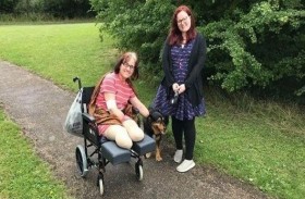 شُفيت من كورونا.. فخسرت يديها وقدميها