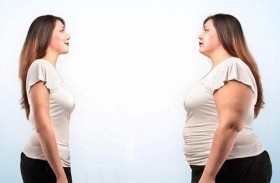 دراسة استمرت 40 عاما تكشف سرا في جراحة إنقاص الوزن