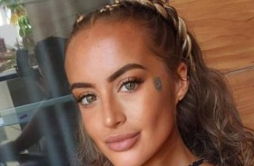 مصرع أم لـ5 أطفال جراء عضة من كلبها 