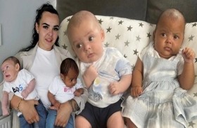 تنجب توأماً من لونين مختلفين