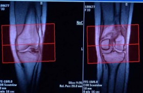 آلام المفاصل والشتاء و روشتة الوقاية